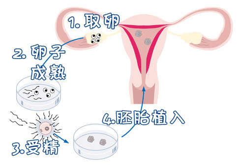 42岁高龄二胎成功案例